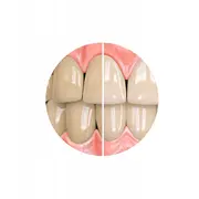 Sensitivity Relief Whitening Toothpaste Pdz,Uni,100  0883205101457 883205101457