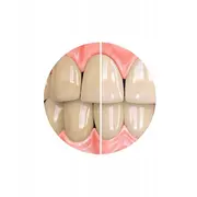 Sensitivity Relief balinošā zobu pasta Pdz.uni.100 Whitening Toothpaste